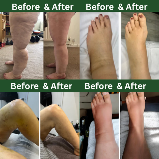 VitalFlowSystem™ Micro Flow Reset Internal Lymphatic Drainage Drops